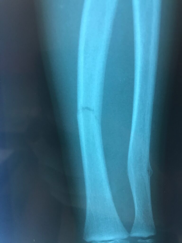 CMK X-ray